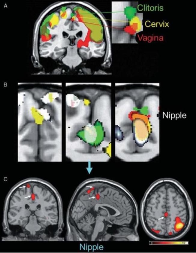 Las diferencias entre las reacciones cerebrales, según el MRI. (Wiley Publishing/Barry Komisaruk)