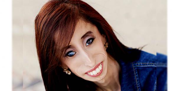 Lizzie Velásquez