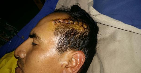 Ronald Soria tiene una herida grande en la cabeza. También le perforaron los intestinos.