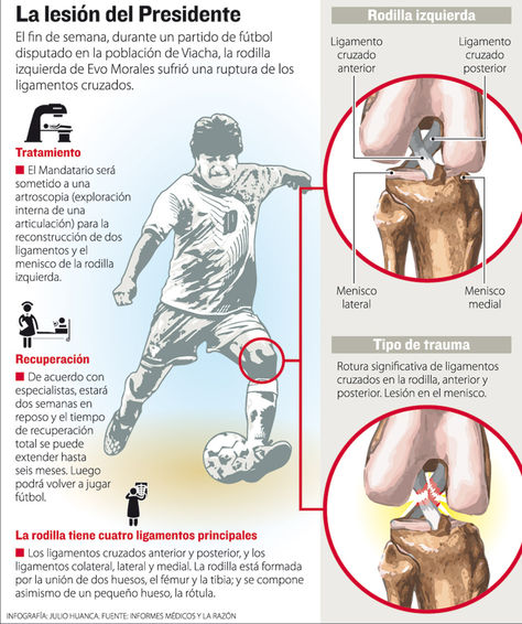 Infografía explicativa sobre la rotura de ligamentos de la rodilla del Presidente Evo Morales. Foto: La Razón