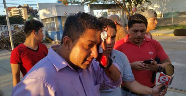 Franklin Cisterna, de Unitel, uno de los periodistas que sufrió lesiones en la cabeza por una pedrada