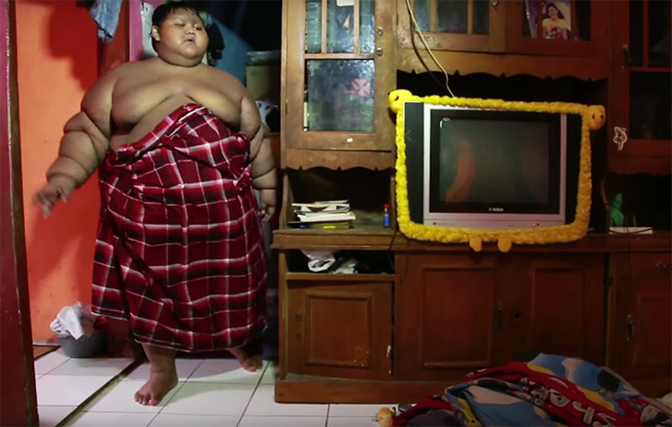 El Drama Del Niño Más Obeso Del Mundo 191 Kilogramos Con Apenas 10 Años Eju Tv