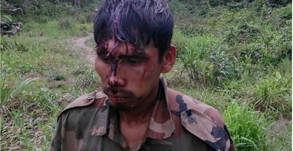 Herido por enfrentamiento