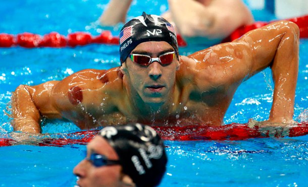 La pseudoterapia que le ha dejado moratones al olímpico Michael Phelps