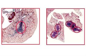 Izquierda: Pulmones de ratones inyectados un mes antes con células de adenocarcinoma que expresan NCoR o en las que se había eliminado este correpresor (derecha). | UAM %image_alt%
