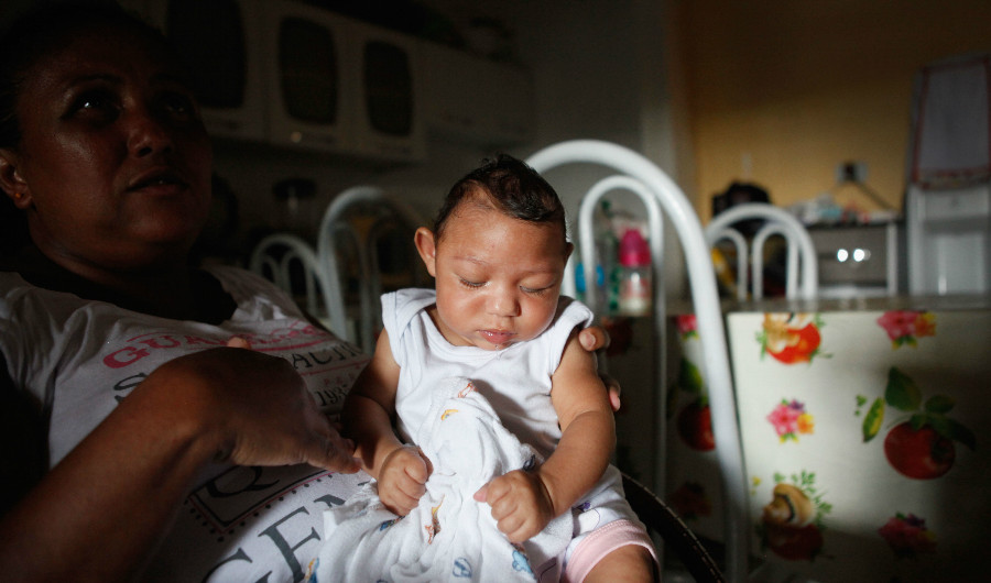 Alice Vitoria Gomes Bezerra sostiene a su hijo de tres meses que tiene microcefalia  en Recife, en Brasil.  En los últimos cuatro meses las autoridades han registrado 4.000 casos de esta condición que estarían relacionados con el zika.(Crédito:Tama/Getty Images)