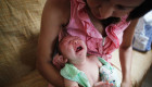 La condición causa que los bebés nazcan con una cabeza anormalmente pequeña. (Crédito: Mario Tama/Getty Images)