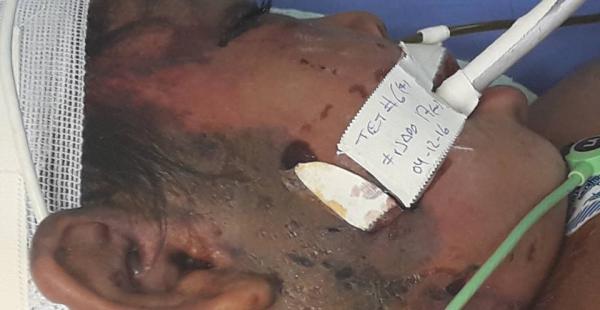 El cuerpo de la menor no aguantó los golpes provocados por el padre y la madrastra de esta menor.