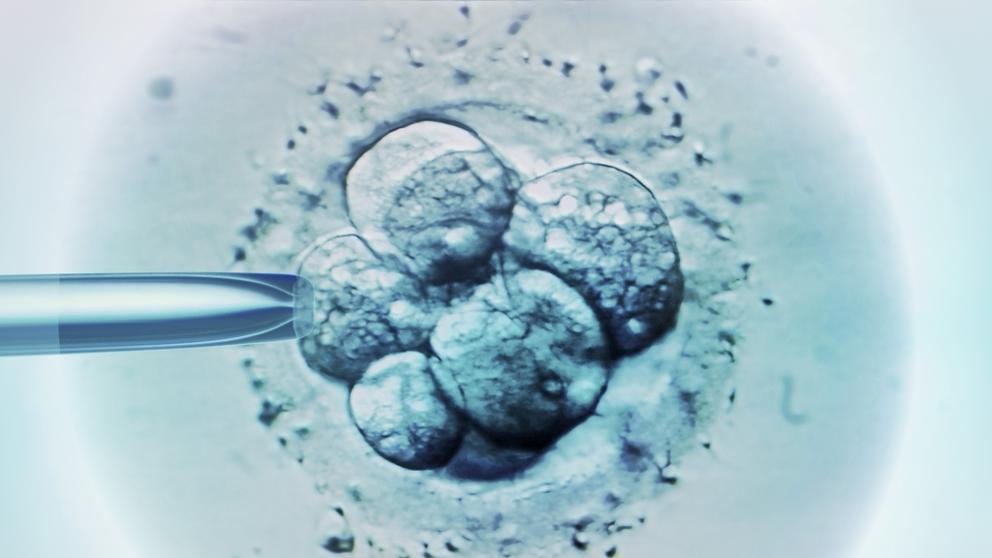 Una veintena de mujeres podrían haber sido inseminadas con el esperma erróneo