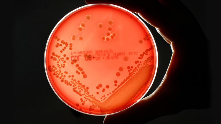 Una nueva 'superbacteria' resistente a los antibióticos alarma a la comunidad científica