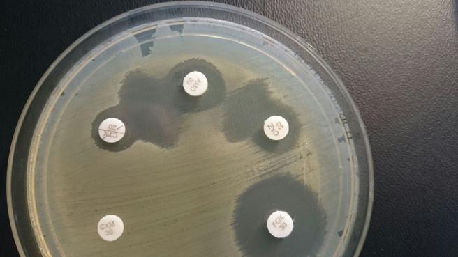 Las bacterias resistentes a los antibióticos, todo un problema para la medicina