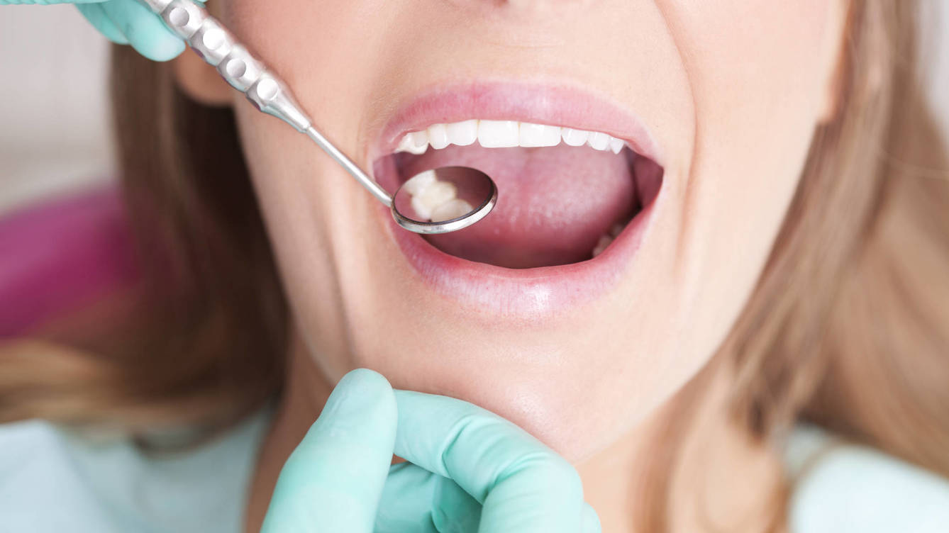 Foto: Una visita al dentista no solo es buena para la caries. (iStock)