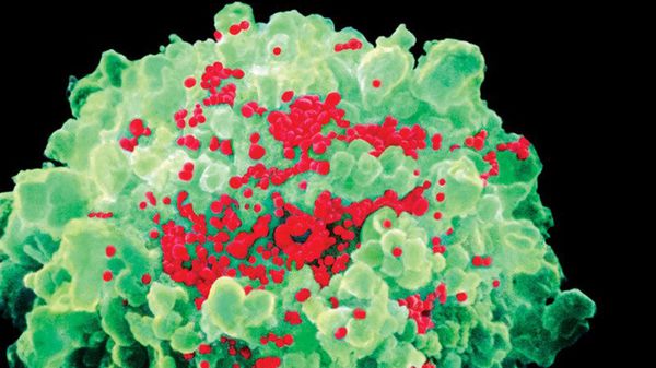 Celulas inactivas de VIH saliendo de su “escondite”