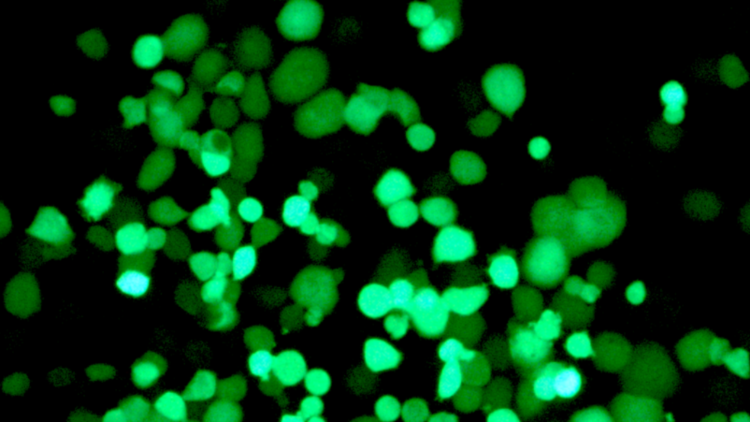 Crean un virus que ataca las células tumorales de forma selectiva