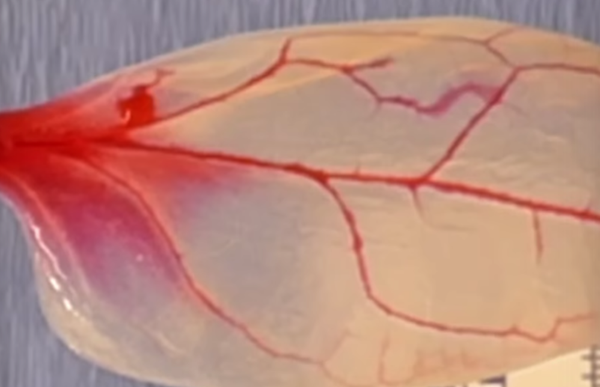 Aunque tienen abordajes muy diferentes, los sistemas de irrigación vegetales y animales tienen similitudes en su estructura. (wpi.edu)