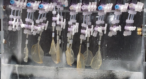 Las hojas de espinaca pueden servir para cultivar músculo cardíaco sano y tratar a pacientes con problemas coronarios. (wpi.edu)