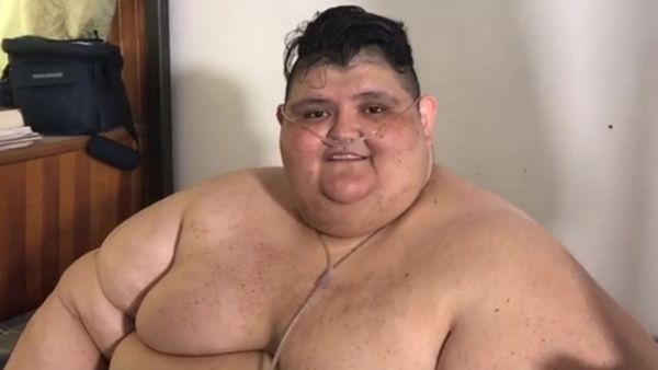 Juan Pedro hoy pesa 420 kilos. Bajó 170 desde los 590 kilos que pesaba a fines de 2016