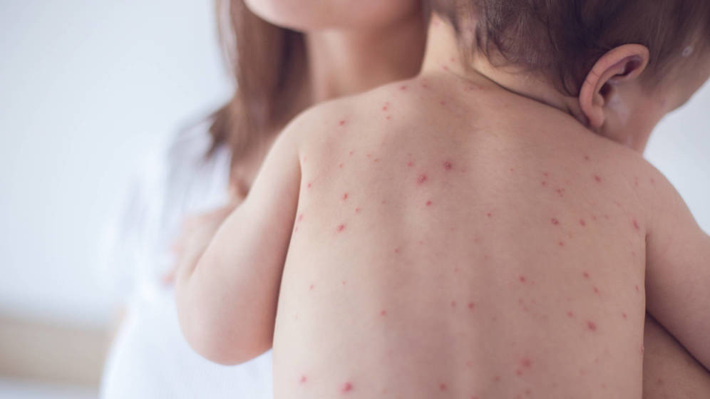 Foto: Las tasas de vacunación han descendido en varios países. (iStock)