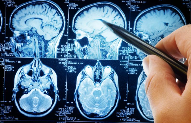 estudio cerebro reconocimiento 2