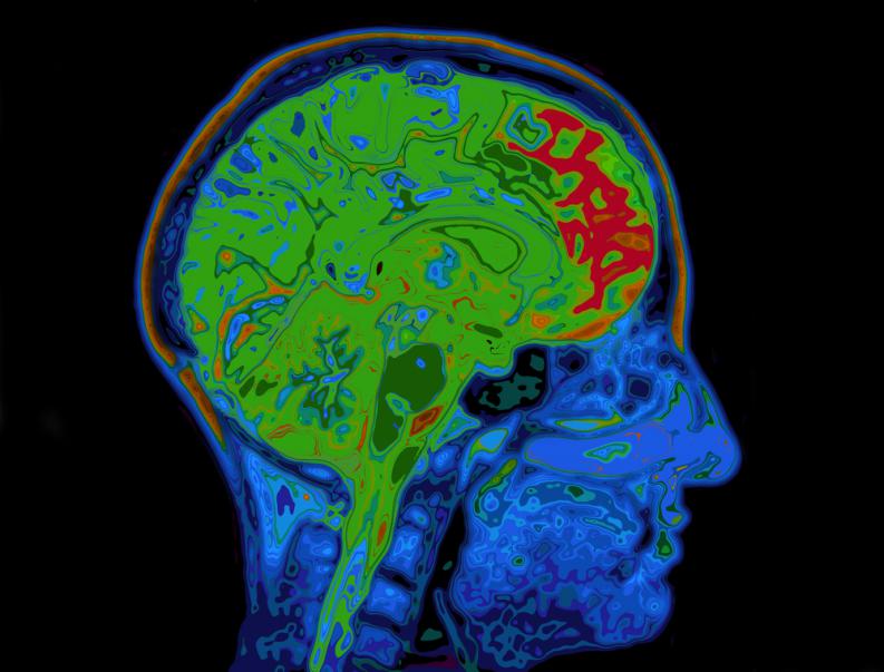estudio cerebro reconocimiento 3