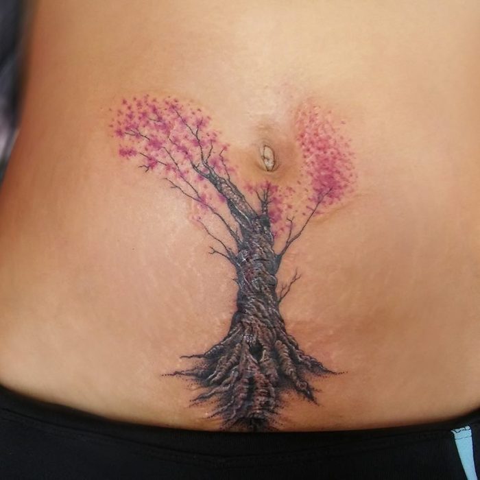 Tatuaje cicatriz