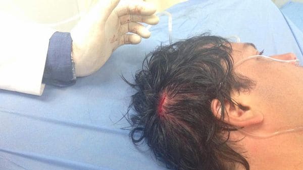 Carlos Paparoni fue herido este lunes