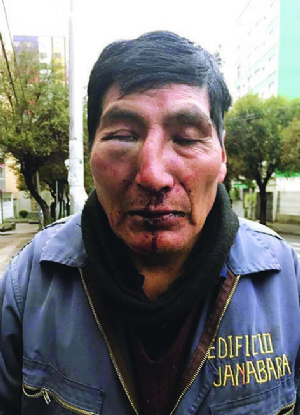 Denuncian golpiza a un portero de céntrico edificio