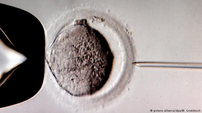In-vitro-Fertilisation (IVF) (picture-alliance/dpa/W. Grubitzsch)