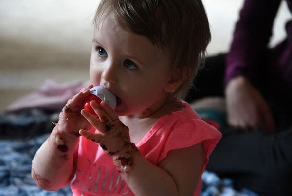 A los bebés como Elizabeth se les denomina “niños con piel de mariposa” porque su piel es tan frágil como las alas de mariposa. (Katherine Frey/ The Washington Post)