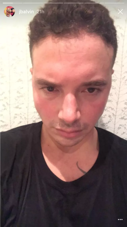 J Balvin