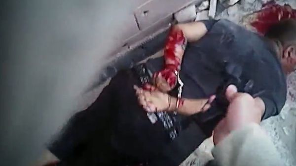 Así quedó el delincuente tras el tiroteo