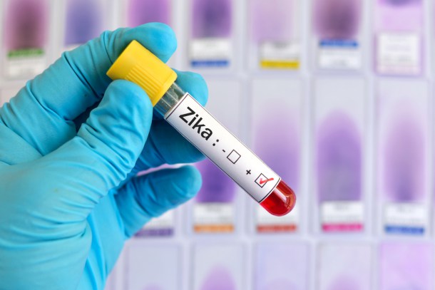 zika por transmisión sexual