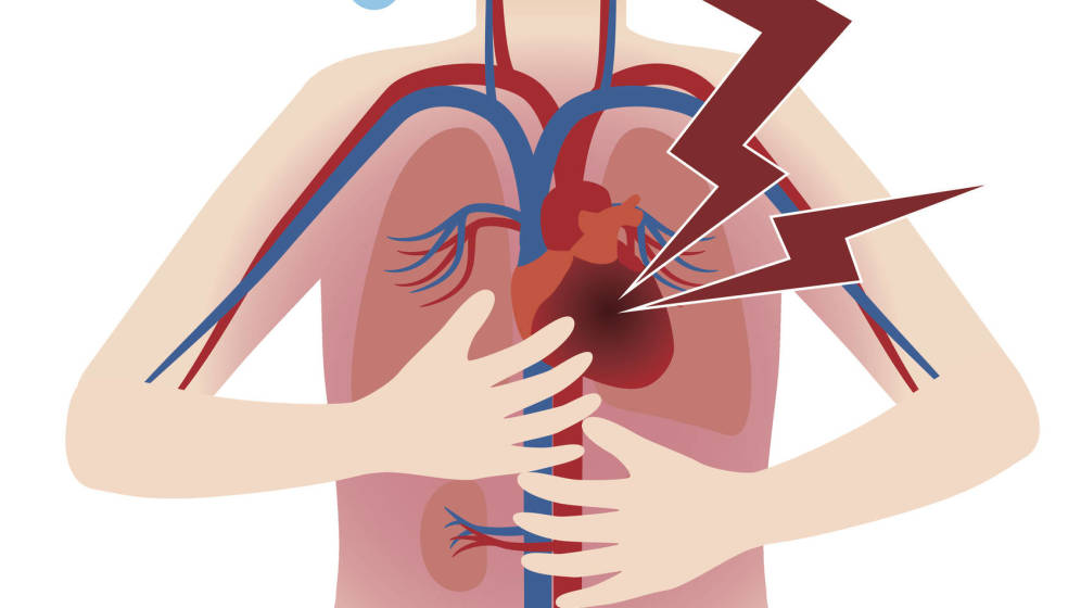 Foto: Foto: iStock.