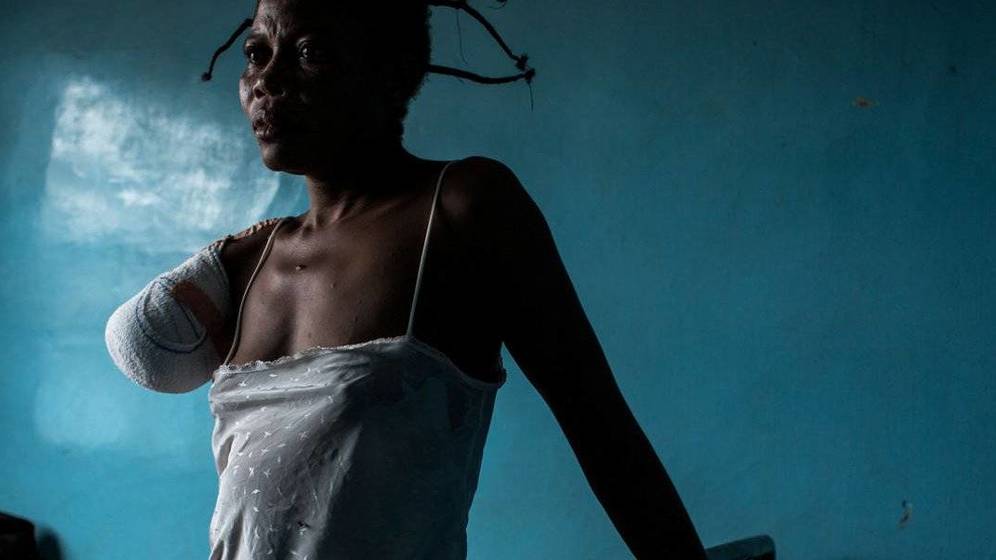 Foto: Una mujer víctima de la violencia de Kasai, refugiada en un hospital de Angola. (Fuente: FIDH)