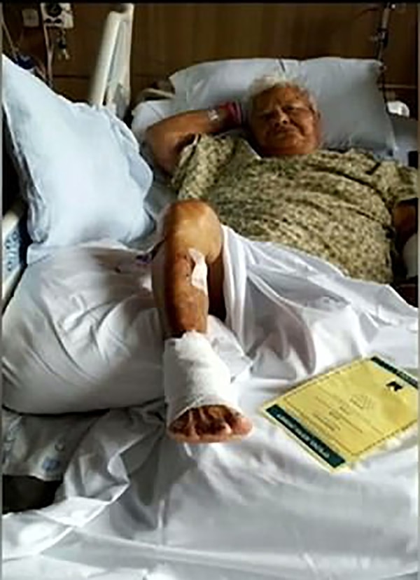 Bernice Kedona en el hospital luego del accidente