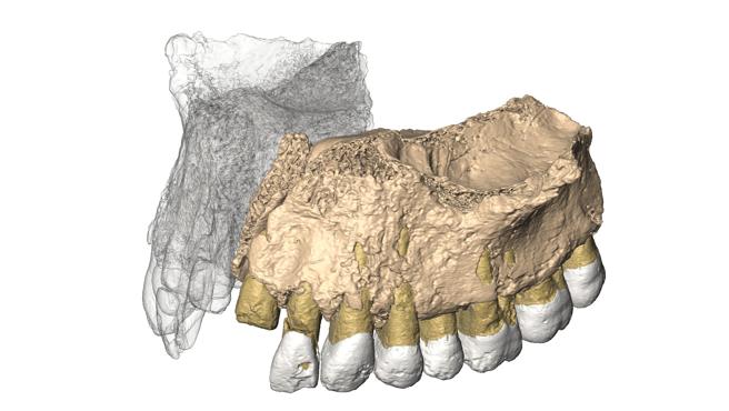 Reconstrucción virtual de la mandíbula hallada en Misliya.