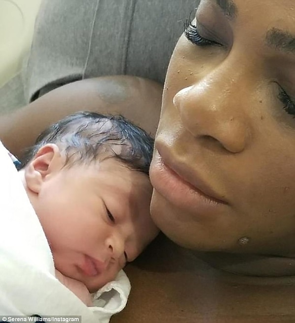 Alexis Olympia Ohanian Jr pesaba 3,01 kilos al nacer
