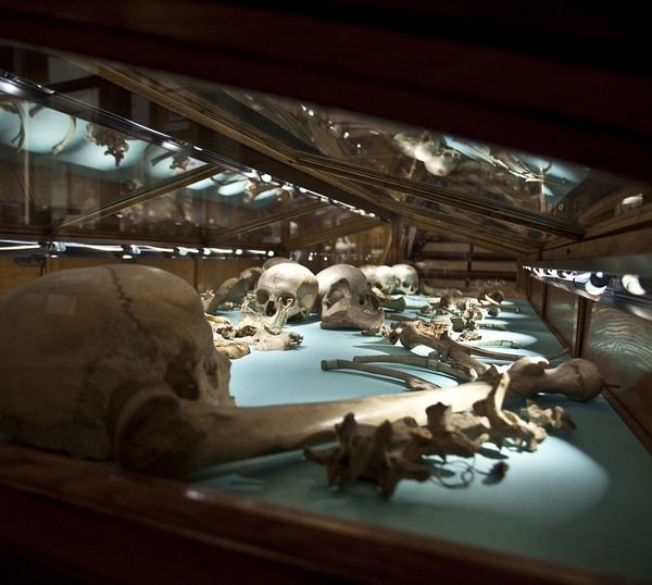 Algunos huesos humanos en el Museo Mütter de Filadelfia (The Mütter Museum of The College of Physicians of Philadelphia / The Washington Post)