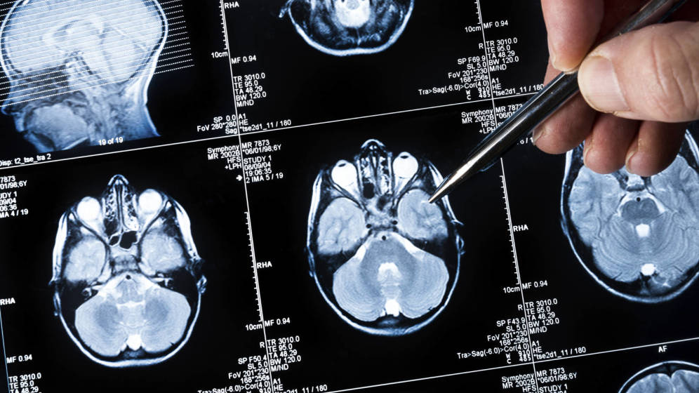 Foto: Foto: iStock. 