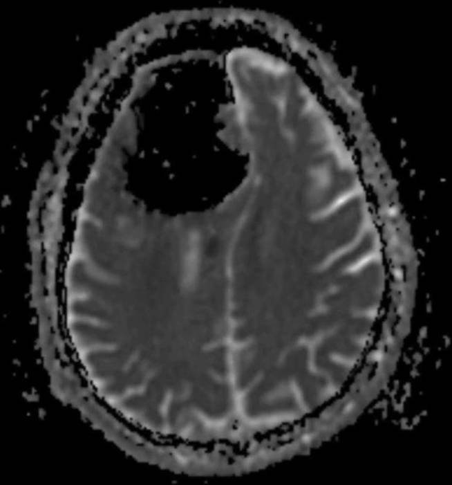 Imagen cenital de la radiografía. (BMJ Studies)