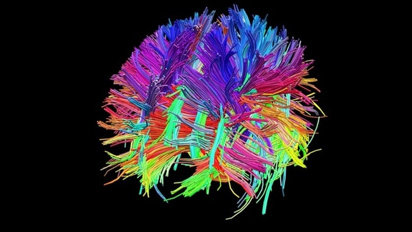 Un conectoma es un mapa de las conexiones entre las neuronas del cerebro.