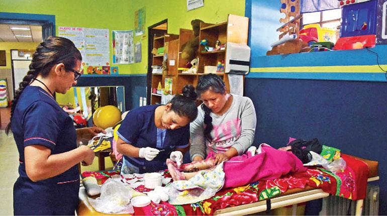 Ariely, la niña con “piel de mariposa”, recibe curaciones en el pabellón de quemados del hospital del niño. | CARLOS LÓPEZ