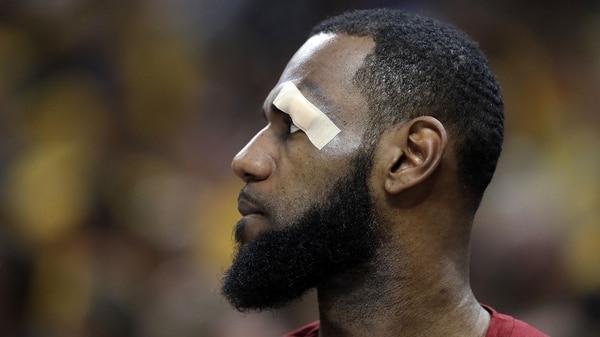LeBron James volvió con un vendaje en su ojo izquierdo