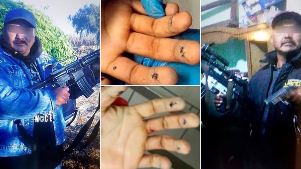 “El Kalimba”, asesinado durante una cirugía plástica en 2017.