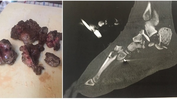 Imágenes cortesía de IncrediblyShinyShart