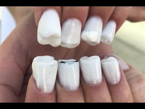 Instagram: esta manicure estÃ¡n siendo viral. Â¡Tiene forma de dientes! 