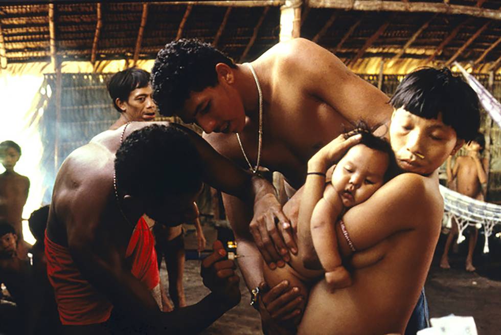 Doctor examina a bebé yanomami enfermo, Balaú, 1996.rn 