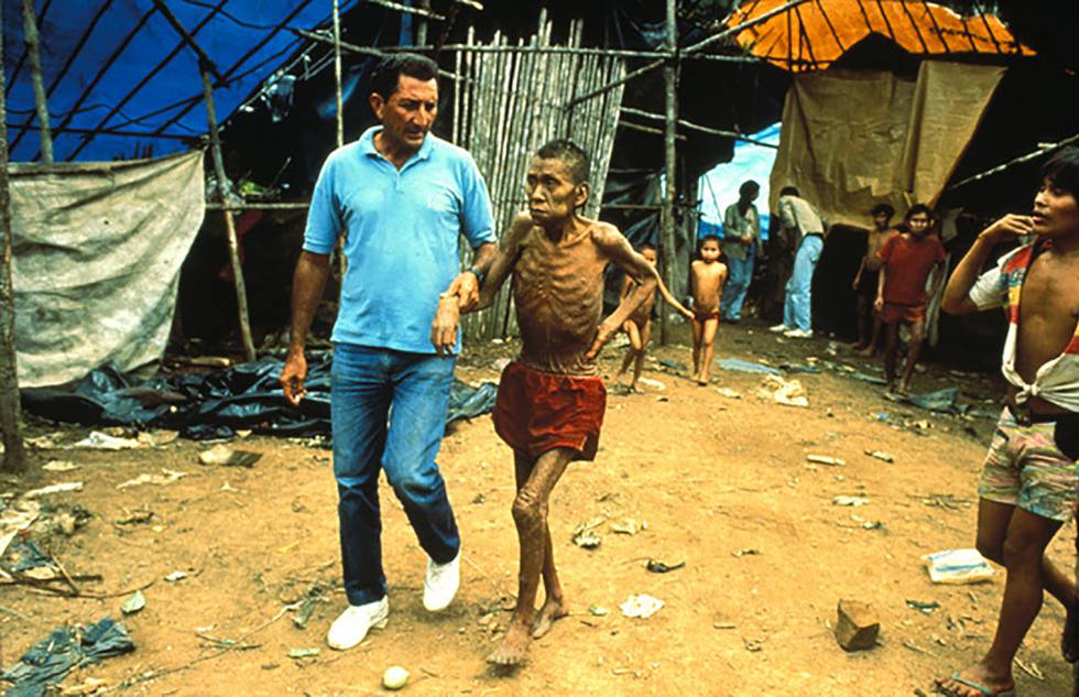 Hombre yanomami enfermo en 1990.