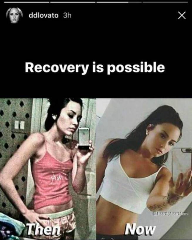Imagen del cambio físico de Lovato compartida por ella misma. (Instagram)
