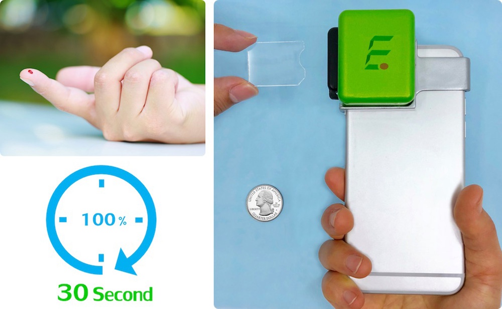 Imagen de iMOST, el accesorio para iPhone que realiza análisis de sangre